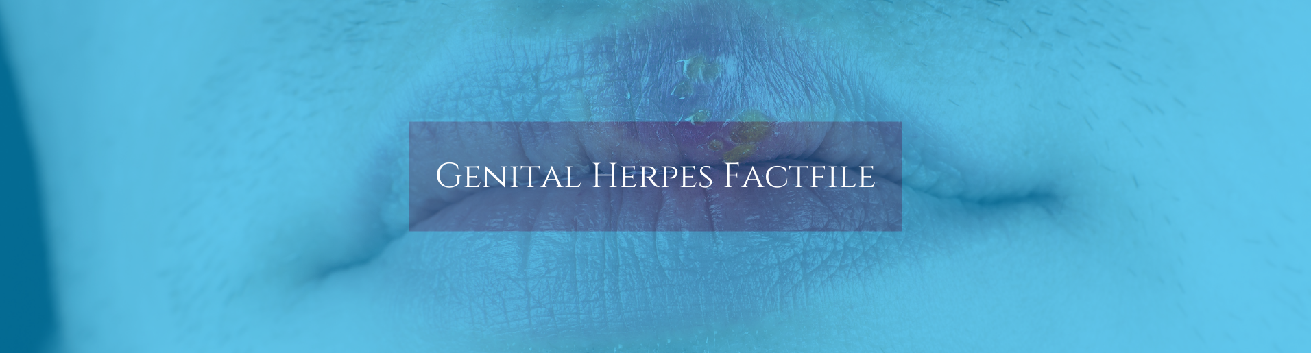 Genital Herpes banner