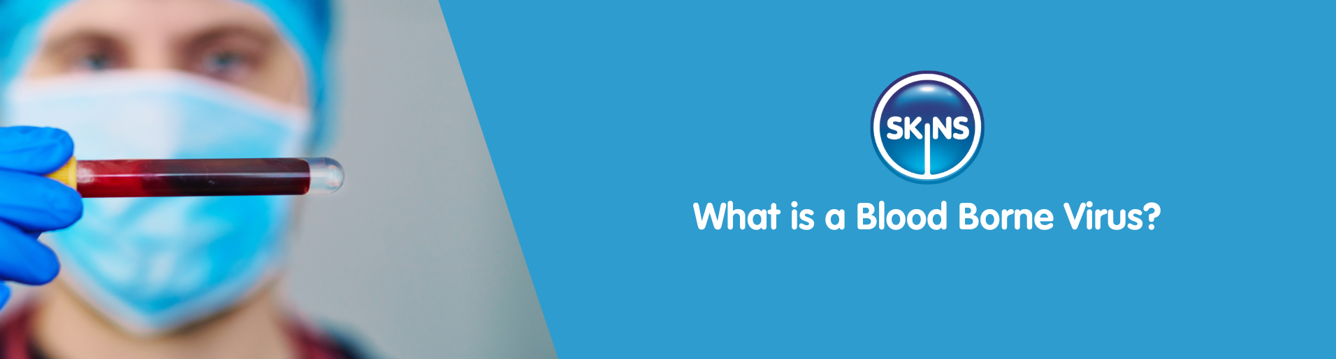 What is a Blood Borne Virus?